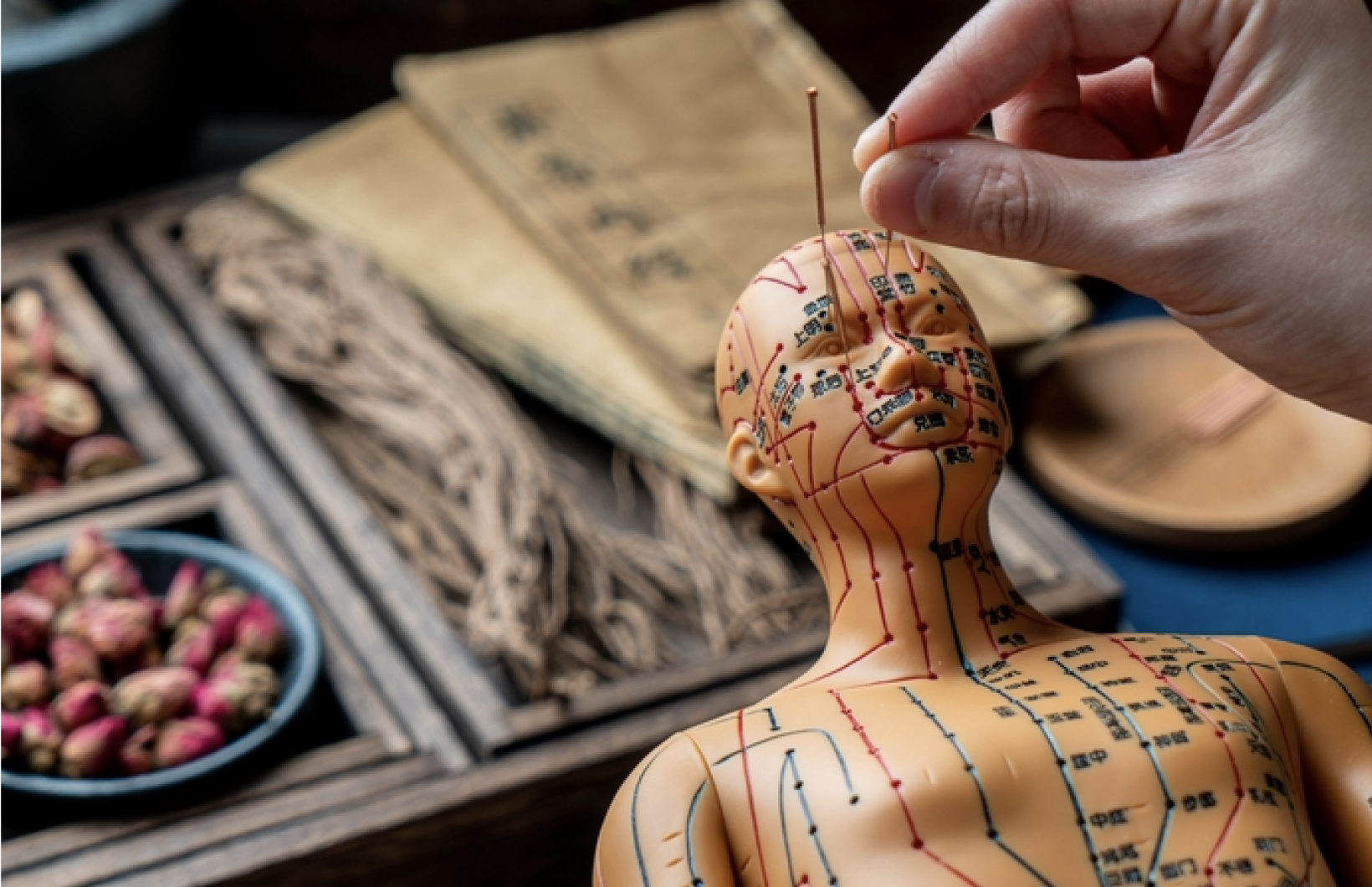 Acupuncture needles are placed on a mannequin, demonstrating their positioning for treatment purposes.