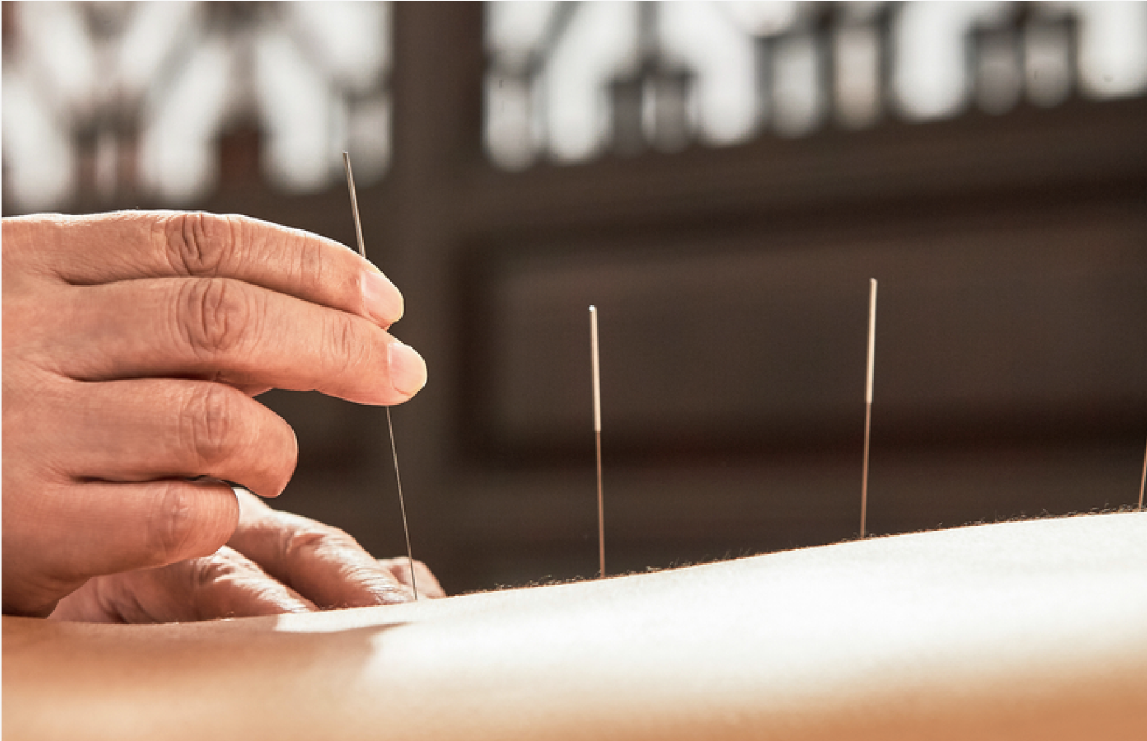A serene acupuncture clinic in a bustling city, showcasing a practitioner treating a patient in a calming environment.